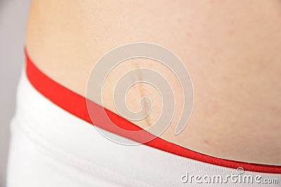 Strecht marks on my belly Stock Photo