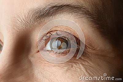 Closeup view of mature woman with cataract Stock Photo