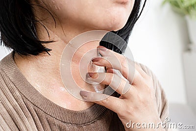 closeup woman hand scratching itchy skin on her neck caused by allergic to sweat Stock Photo