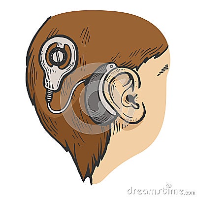 Cochlear implant color sketch engraving vector Vector Illustration