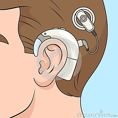 Cochlear implant diagram medical science Cartoon Illustration