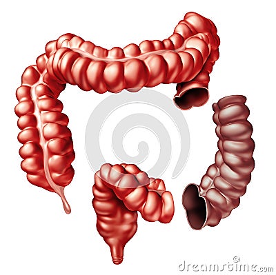 Colectomy Colon Surgery Stock Photo