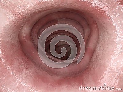 Colitis ulcerosa - Stage 0 - 3D rendering Stock Photo