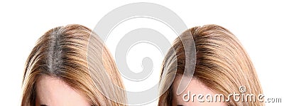 Collage of woman with grey hair before and after coloring on background, closeup. Banner design Stock Photo