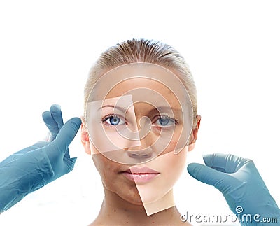 Collage with woman's portrait and hands in medical gloves. Stock Photo