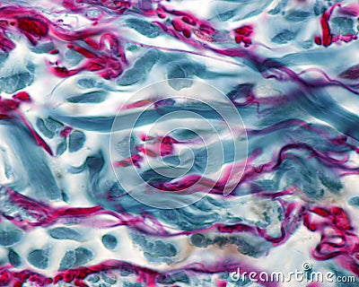 Collagen and elastic fibers. Cajal-Gallego trichrome Stock Photo