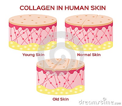 Collagen in younger skin and aging version Vector Illustration