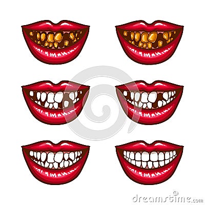 A collection of pop art icons of red female lips - smiling, with missing teeth, with spoiled teeth Vector Illustration