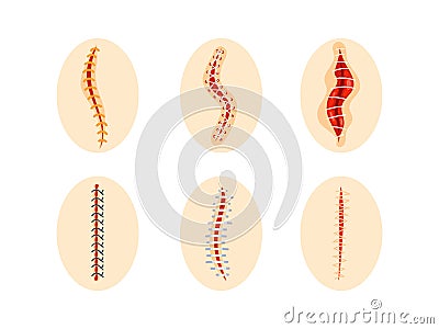 Collection of round icons representing various sutured wounds in different configurations, showing the process of Vector Illustration