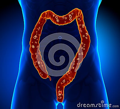 Colon Anatomy - pain Stock Photo