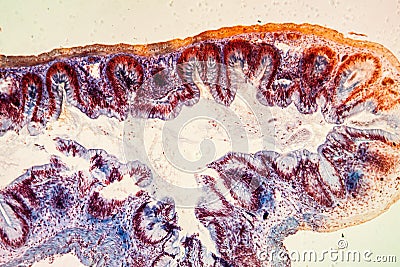 Colon with villi tissue Stock Photo