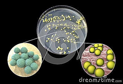 Colonies of bacteria grown from human skin Cartoon Illustration