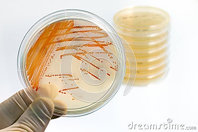 Colonies of bacteria Streptococcus agalactiae in culture medium Stock Photo