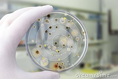 Colonies of different bacteria and mold fungi grown on Petri dish with nutrient agar Stock Photo