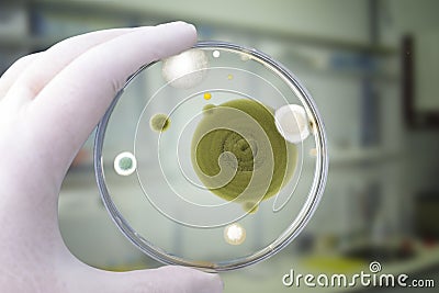 Colonies of different mold fungi grown from indoor air Stock Photo