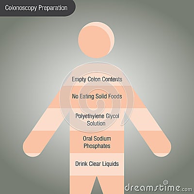 Colonoscopy Chart Vector Illustration