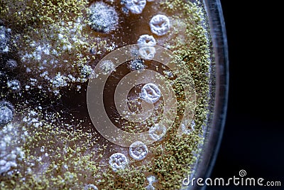 Characteristic of Actinomyces, Bacteria, yeast and Mold on selective media from soil samples for study in laboratory microbiology. Stock Photo