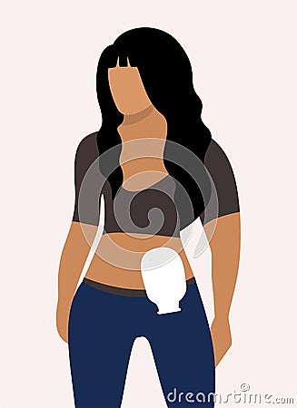 Colostomy bag. Young woman wearing colostomy bag. Vector isolated illustration Cartoon Illustration
