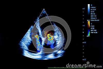 Colourful image of homan heart ultrasound monitor Stock Photo