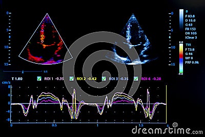 Colourful image of homan heart ultrasound monitor Stock Photo