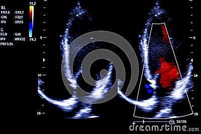 Colourful image of homan heart ultrasound monitor Stock Photo