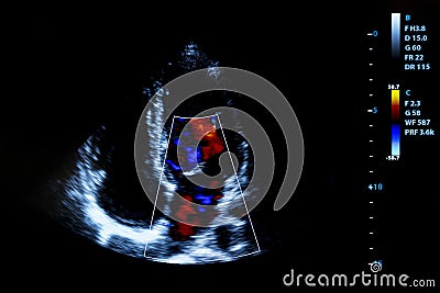 Colourful image of homan heart ultrasound monitor Editorial Stock Photo