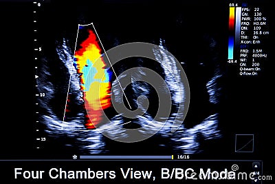 Colourful image of homan heart ultrasound monitor Stock Photo