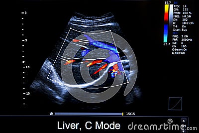 Colourful image of modern ultrasound monitor Stock Photo