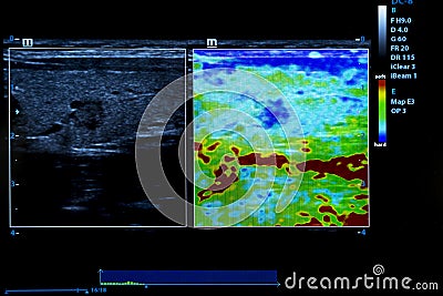 Colourful image of modern ultrasound monitor Stock Photo