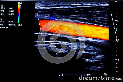 Colourful image of modern ultrasound monitor Stock Photo