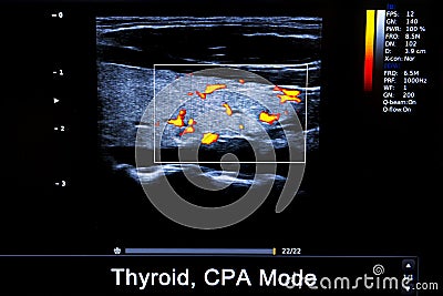 Colourful image of modern ultrasound monitor Stock Photo