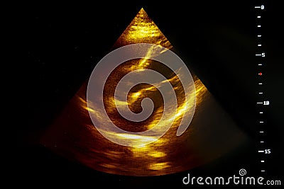 Colourful image of pregnancy ultrasound monitor Stock Photo