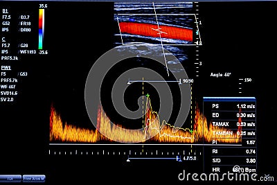 Colourful image of modern ultrasound monitor Editorial Stock Photo