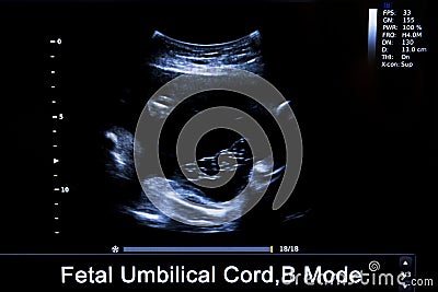 Colourful image of pregnancy ultrasound monitor Stock Photo