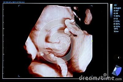 Colourful image of pregnancy ultrasound monitor Stock Photo