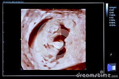 Colourful image of pregnancy ultrasound monitor Stock Photo