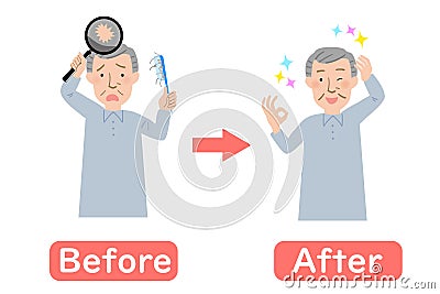 With a comb, Grandpa suffering from hair thinning hair before-after-vector illustration Vector Illustration