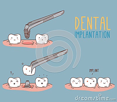 Comics about tooth replacement. Vector Vector Illustration