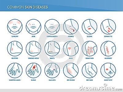 Common skin diseases Vector Illustration