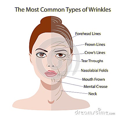 Common Types of Facial Wrinkles. cosmetic surgery. woman facial treatment Vector Illustration