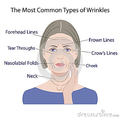 Common Types of Facial Wrinkles. cosmetic surgery. woman facial treatment Vector Illustration