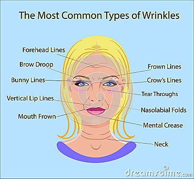 Common Types of Facial Wrinkles. cosmetic surgery. woman facial treatment isolated Vector Illustration