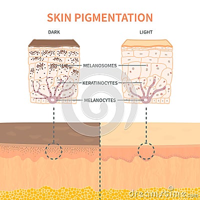 Skin tone pigmentation mechanism infographic medical diagram Vector Illustration