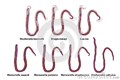 Comparison of microfilariae morphology Cartoon Illustration