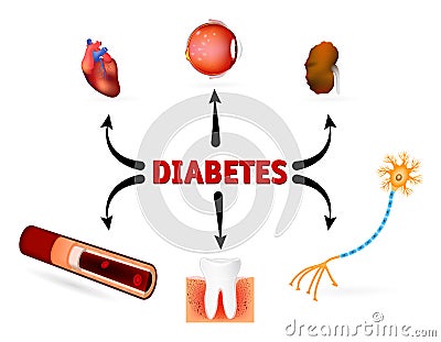 Complications of diabetes mellitus Vector Illustration