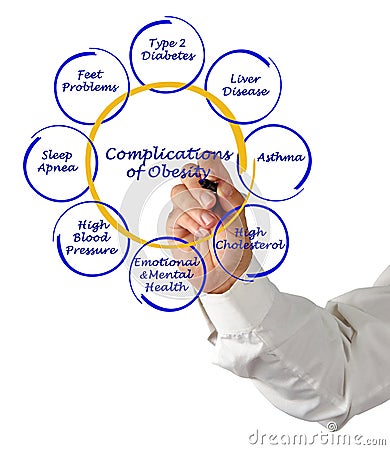 Complications of Obesity Stock Photo
