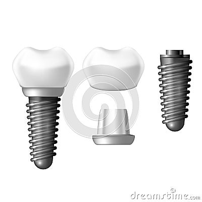 Component parts of dental implant - teeth denture Vector Illustration