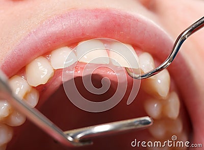 Comprehensive dental examination Stock Photo