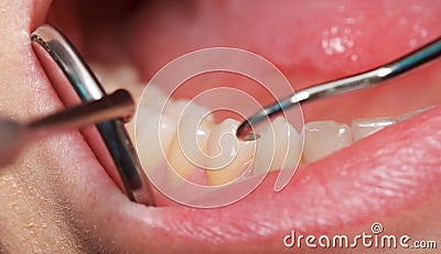 Comprehensive dental examination Stock Photo