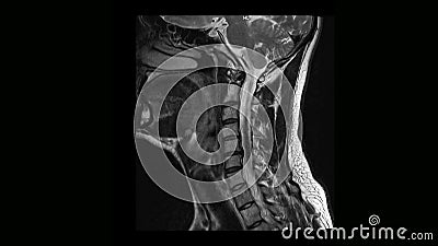 csípőízületi artrózis 1 fokos kezelés rajz fájdalom a gerincben a mellkasban